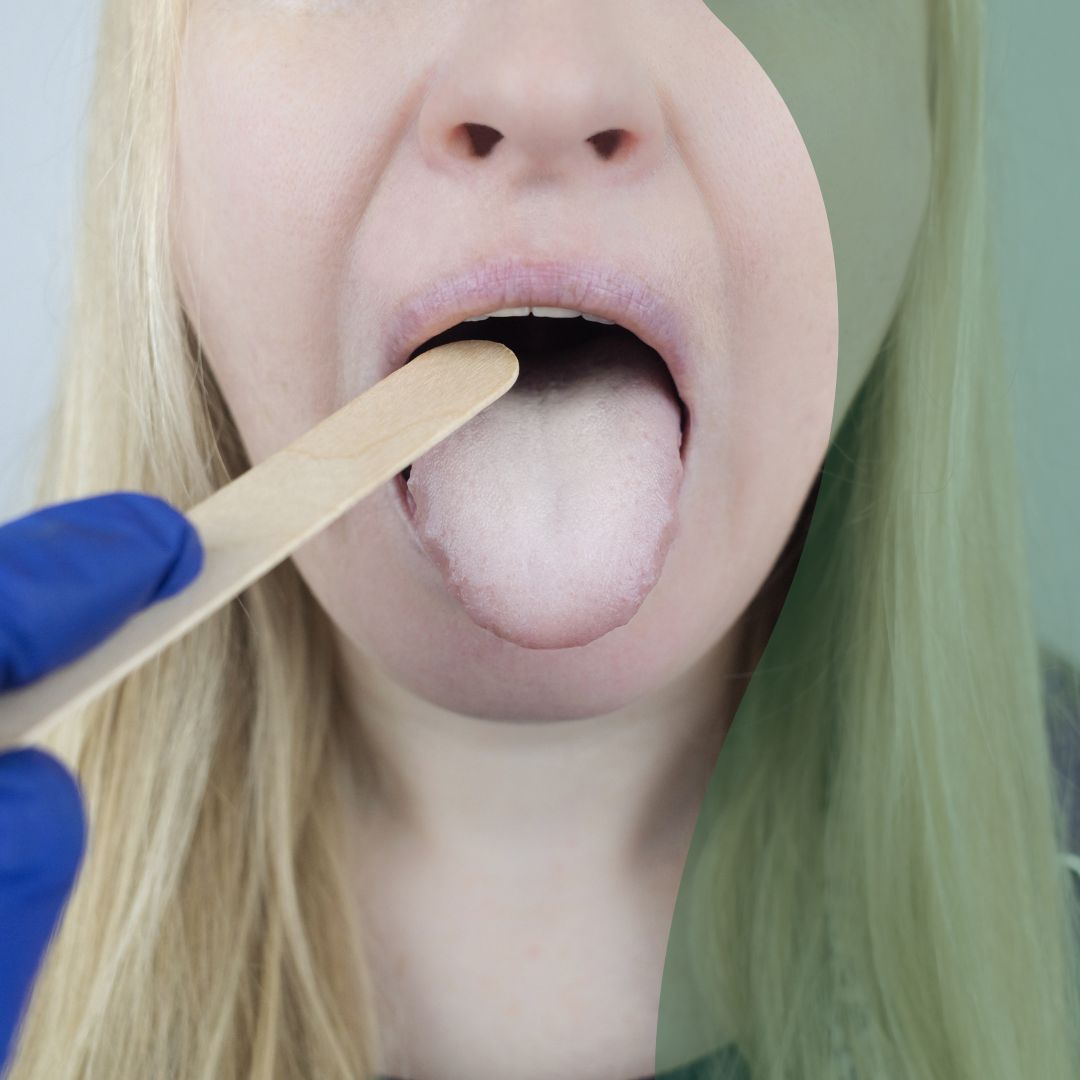 Pack Candidiasis  (1 bote de Alkimia + 3 de Candidefens)