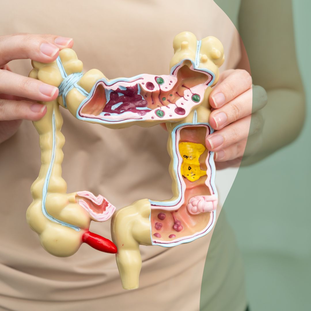 Pack LIMPIEZA INTESTINAL ( 1 ALKIMIA +1 SACURASOL + 1 NATURMAG)